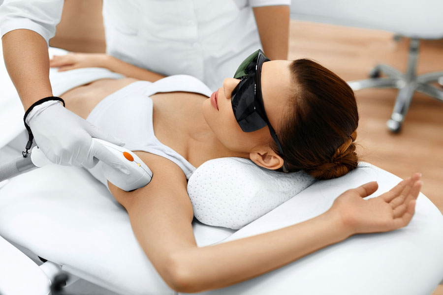 Laser hair removal