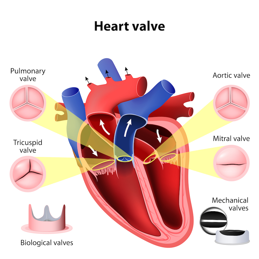 Replacement of cardiac valves