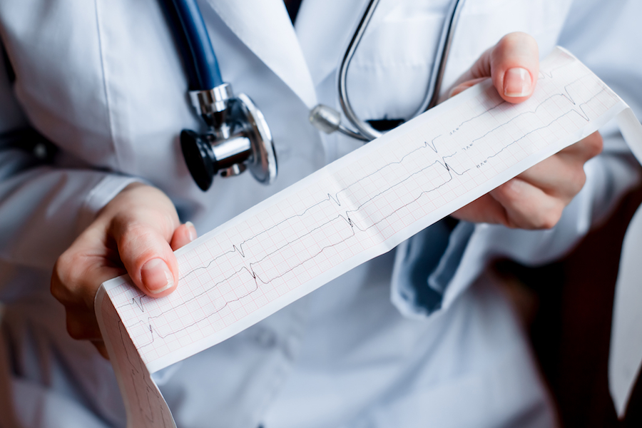 Electrocardiogram (ECG)