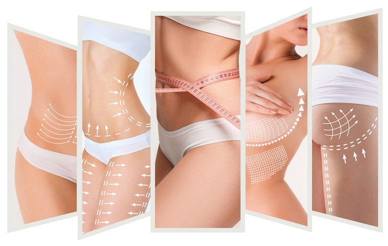 Breast reconstruction by fat transfer