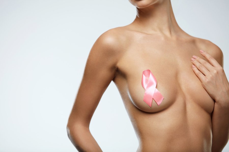 Preventive breast removal